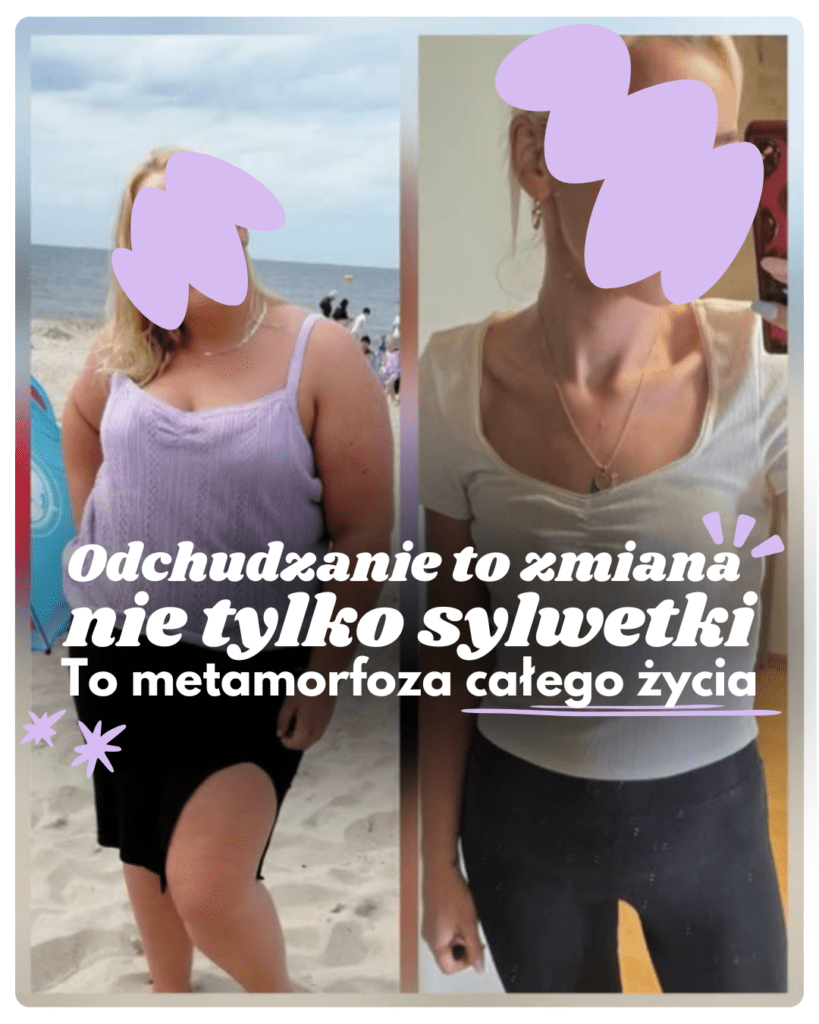 metamorfoza-pacjenta-1-zdjecie-1